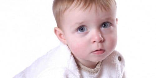 هیدروسفالی کودکان