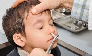 سینوزیت در کودکان