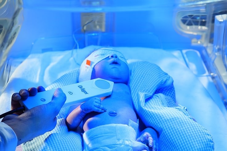 درمان با دستگاه فتوتراپی