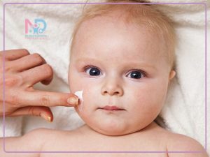 خشکی-پوست-کودکان