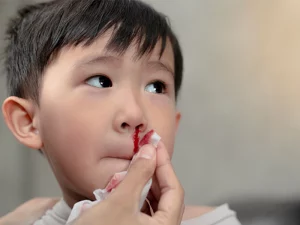 خون دماغ شدن در کودکان