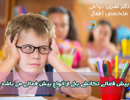 بیش فعالی تکانشی