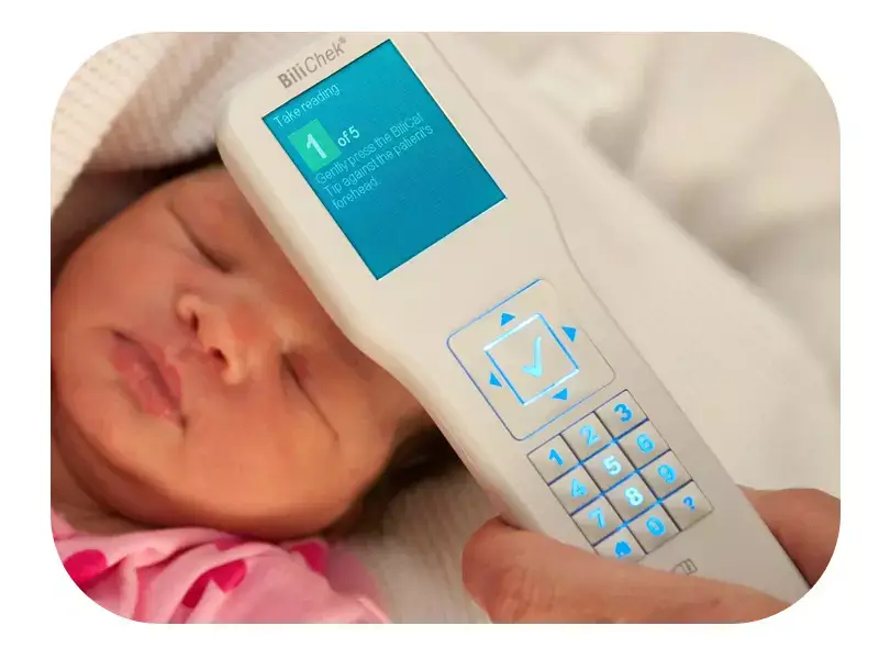 نتایج تست زردی نوزاد با دستگاه بیلی روبین