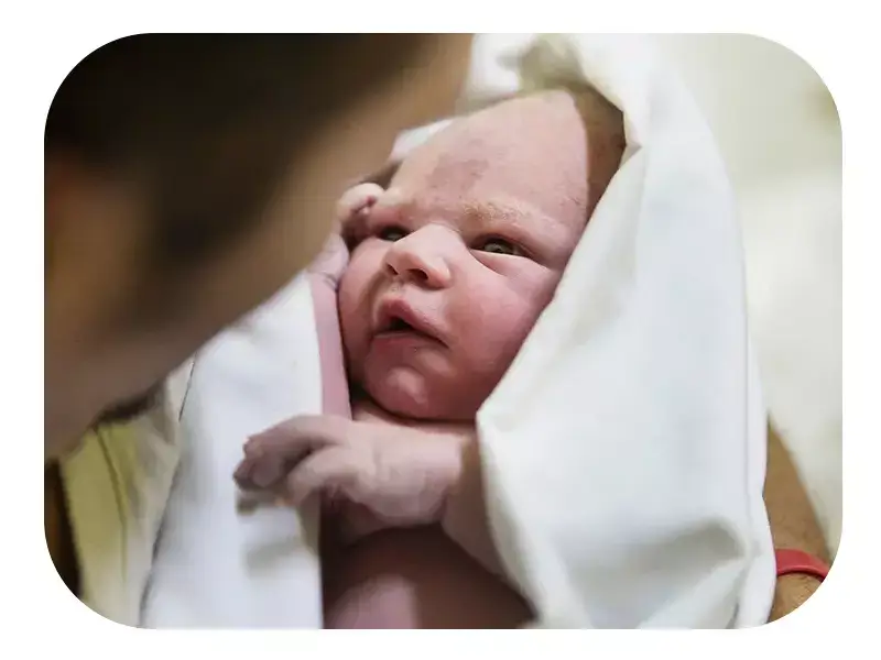 زردی نوزاد و تشخیص آن بدون خونگیری