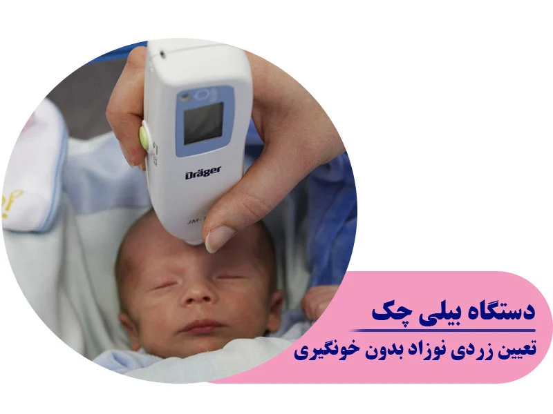 تعیین زردی نوزاد بدون خونگیری